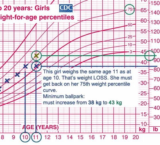 Girls growth chart- No weight gain - suppression - anorexia ARFID